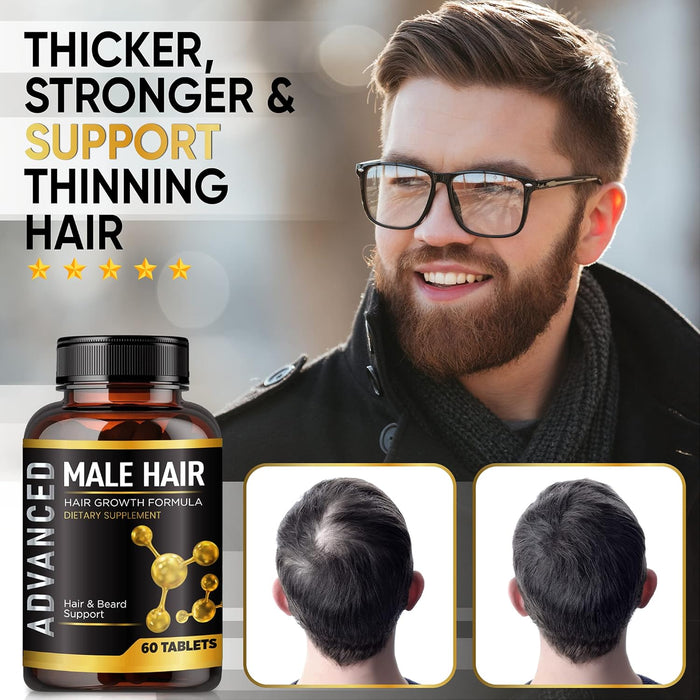 Vitaminas para el crecimiento del cabello para hombres: píldoras vitamínicas de apoyo contra la caída del cabello y bloqueador de DHT para hombres.